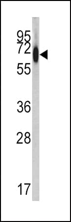 Polyclonal Rabbit anti-Human ALB / Serum Albumin Antibody (aa540-569, IHC, WB)