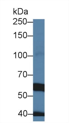 TRPM7 Antibody (aa19-179)