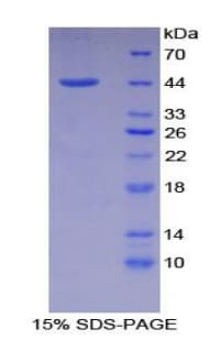 Mouse EMA / MUC1 Protein (Recombinant His-GST)