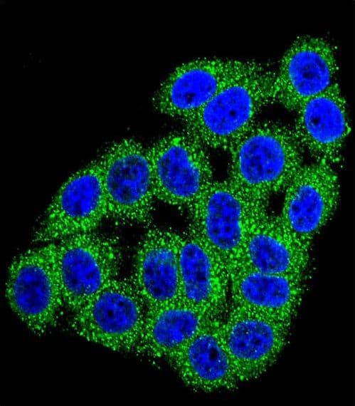 CPB / Carboxypeptidase B Antibody (aa9-37)