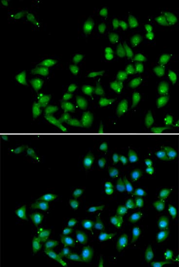 CTNNBL1 / NAP Antibody