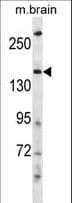 Polyclonal Rabbit anti-Human NEDL2 / HECW2 Antibody (aa848-876, WB)