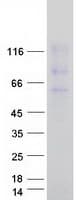 Human UBAP2L Protein (Recombinant Myc-DDK (Flag))