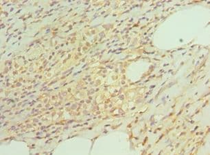 TAC1 Antibody (aa1-129)