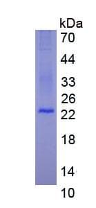 Human CD95 / FAS Protein (Recombinant)