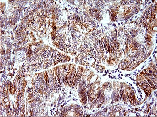 HERPUD1 / HERP Antibody (clone OTI1A2)