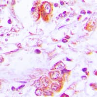 FST / Follistatin Antibody (Internal)