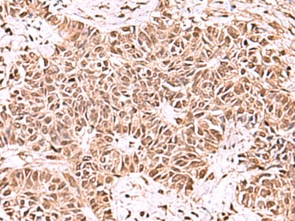 BAF53B / ACTL6B Antibody