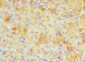 GJC1 / CX45 / Connexin 45 Antibody (aa247-396)