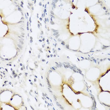 CCL22 / MDC Antibody