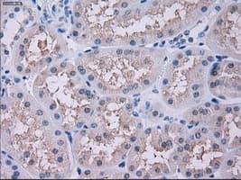 Monoclonal Mouse anti-Human SORD / Sorbitol Dehydrogenase Antibody (clone OTI9E7, IHC, IF, WB)