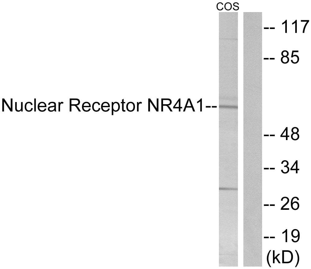 NR4A1 / NUR77 Antibody (p351)