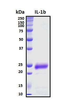 Human IL-1B / IL-1 Beta Protein (Recombinant His, N-Terminal)