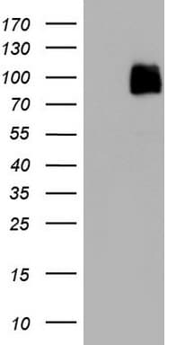 KDR / VEGFR2 / FLK1 Antibody (aa786-1356, clone OTI2D7)