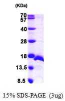 Human SF3B6 / SF3B14 Protein (Recombinant His)