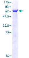 Human BABAM1 / HSPC142 Protein (Recombinant GST)