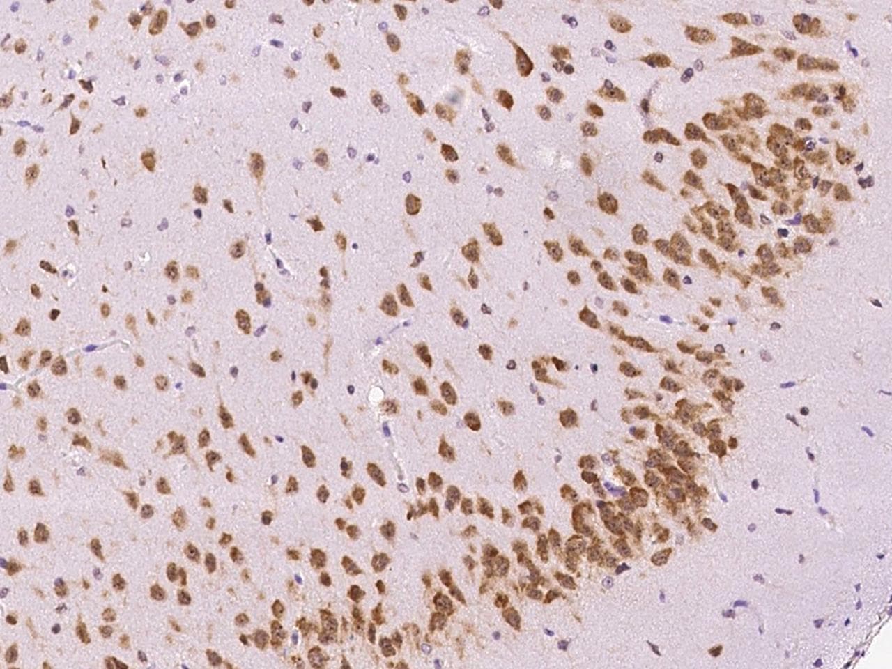 RPS6 / Ribosomal Protein S6 Antibody