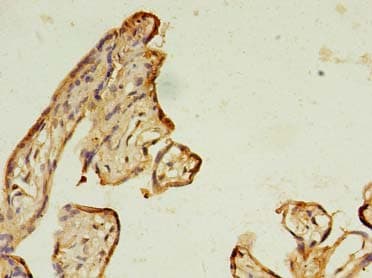 IHC-plus™ Polyclonal Rabbit anti-Human RAB11B Antibody (IHC, WB)