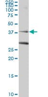 RAD51C Antibody (clone 3F3-5C6)