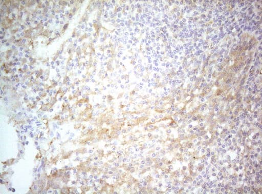 TWF1 / PTK9 Antibody (aa140-384, clone OTI5C12)