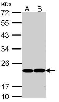 IHC-plus™ GPX1 / Glutathione Peroxidase Antibody