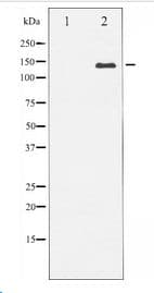 CML / BCR Antibody