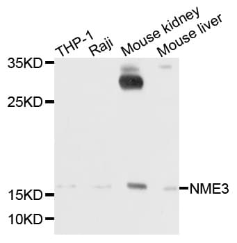 Polyclonal Rabbit anti-Human NME3 Antibody (WB)