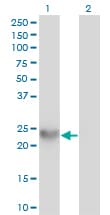 IHC-plus™ SPRR3 Antibody (clone 4A12)