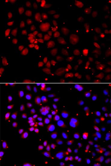 Polyclonal Rabbit anti-Human SNAI2 / SLUG Antibody (IHC, IF, WB)