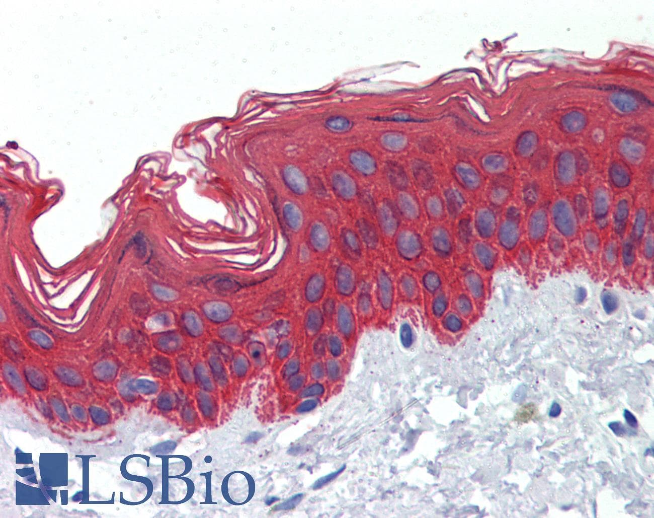 IHC-plus™ KRT5 / CK5 / Cytokeratin 5 Antibody (clone 10)