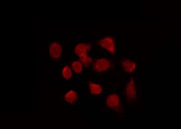 FOXE2 / FOXE1 Antibody