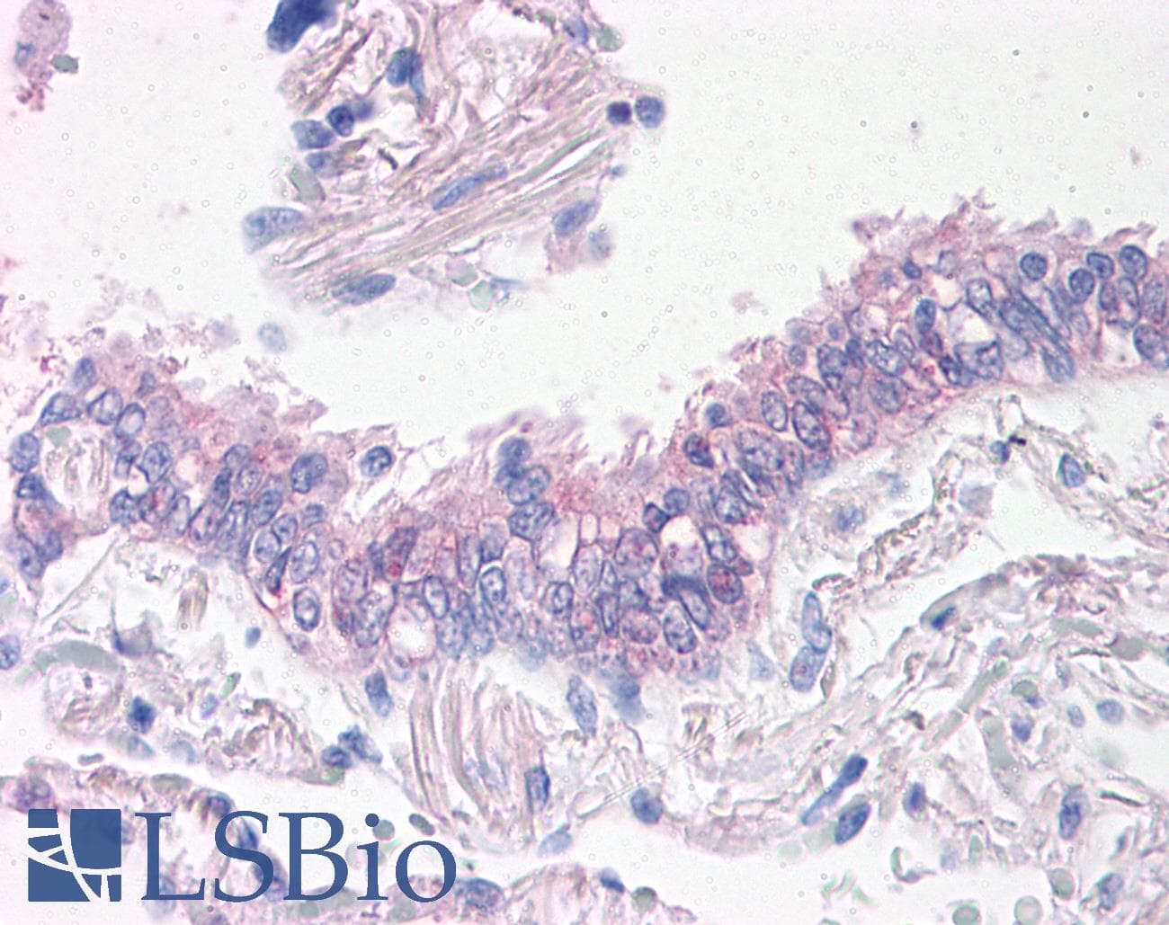 IHC-plus™ Prominin 2 / PROM2 Antibody (Internal)