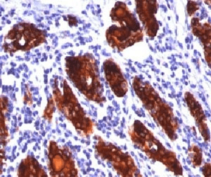 TG / Thyroglobulin Antibody (clone 2H11 or TGB04, Ready-to-Use)
