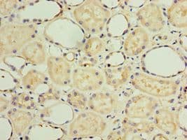 GS28 / GOSR1 / p28 Antibody (aa1-115)