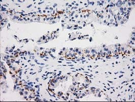 Monoclonal Mouse anti-Human MGLL / Monoacylglycerol Lipase Antibody (clone OTI 2B6, IHC, WB)