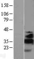 KLF13 Protein (Over-Expression Lysate Myc-DDK (Flag))