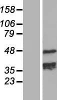 TCHP Protein (Over-Expression Lysate Myc-DDK (Flag))