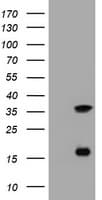 TS / Thymidylate Synthase Antibody (clone OTI5H8, Carrier-free)