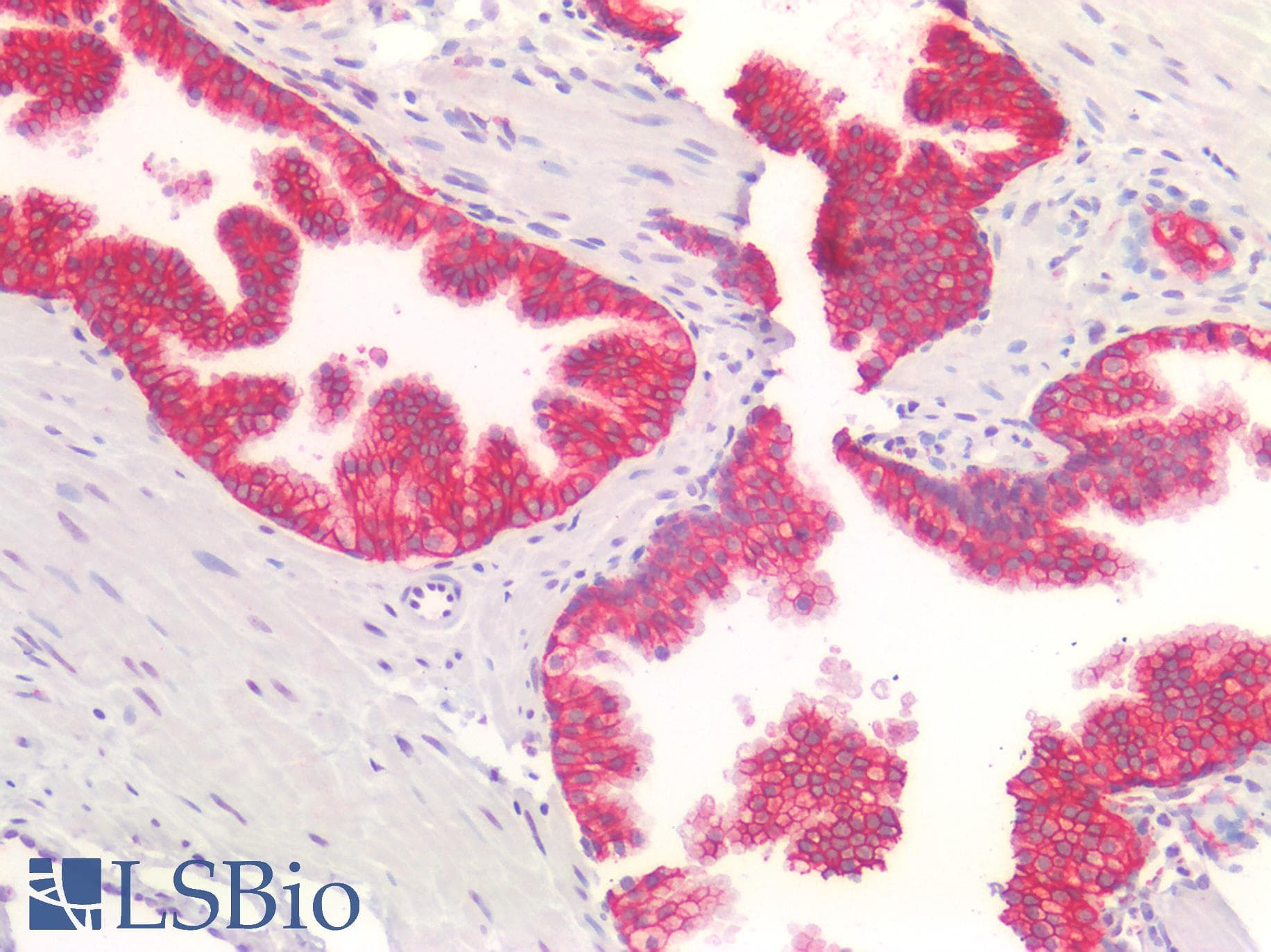 PathPlus™ CDH1 / E Cadherin Antibody (C-Terminus)