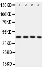 PDK2 Antibody (aa379-392)