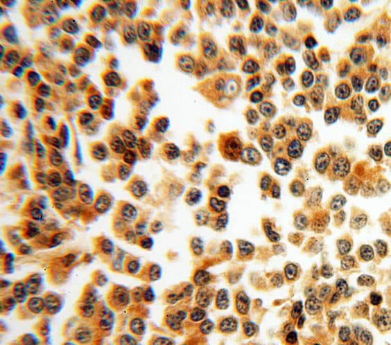 Polyclonal Rabbit anti-Human BAX Antibody (IHC, WB)