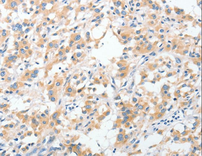 Polyclonal Rabbit anti-Human RPN1 / Ribophorin I Antibody (IHC, WB)
