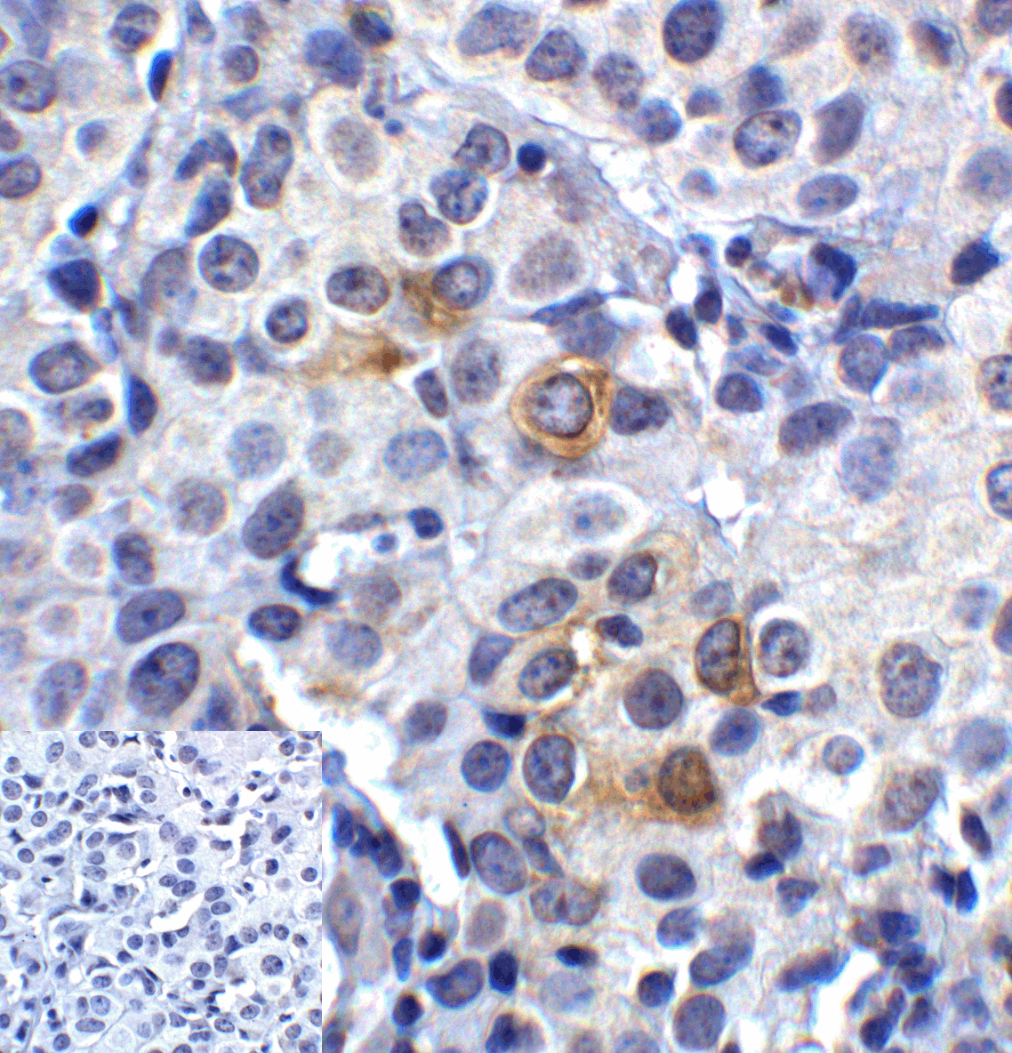 PathPlus™ Monoclonal Mouse anti-Human LAG3 Antibody (clone 9F9, IHC, IF)