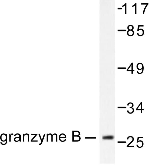 Polyclonal Rabbit anti-Human GZMB / Granzyme B Antibody (Glu20, IHC, WB)