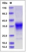 Mouse EPO / Erythropoietin Protein (Recombinant His,C-terminus)