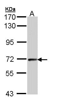 Polyclonal Rabbit anti-Human CCNT2 / Cyclin T2 Antibody (aa497-730, IHC, WB)