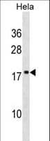 Polyclonal Rabbit anti-Human SCAND1 Antibody (aa150-179, WB)