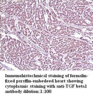 TGFB1 / TGF Beta 1 Antibody