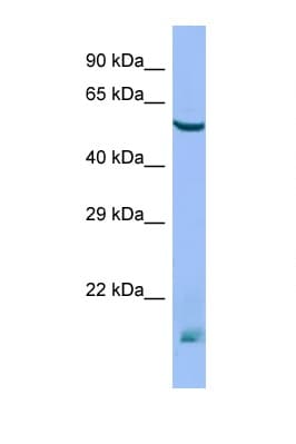 Polyclonal Rabbit anti-Mouse MTM1 / Myotubularin Antibody (N-Terminus, WB)