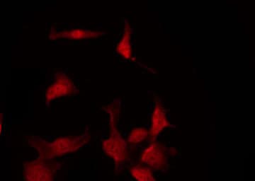 AKT1 Antibody (phospho-Thr308)